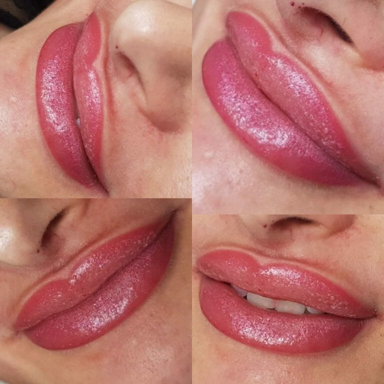 Przez 3-5 dni po zabiegu należy przyjmować tabletki HEVIRAN. Miejsce poddane pigmentowaniu należy traktować szczególnie delikatnie. Nie wolno moczyć, trzeć, drapać i dotykać pigmentowanego miejsca. W żadnym wypadku usta nie mogą być myte mydłem ani traktowane innymi kosmetykami niż zalecane przez linergistkę. Nie należy korzystać z sauny, solarium (nawet 3-4 tygodnie), zabiegów SPA oraz basenu. Usta należy nawilżać kilka razy dziennie, smarując pigmentowaną powierzchnię bardzo cienką warstwą otrzymanym po zabiegu preparatem. Uwaga! W przypadku nie przestrzegania powyższych zasad mogą wystąpić odbarwienia. Po zagojeniu: Nie należy dopuszczać do wysuszania oraz mocnego opalania pigmentowanej skóry, stosować pomadkę z filtrem UV. Należy również unikać agresywnych peelingów w miejscu makijażu trwałego.